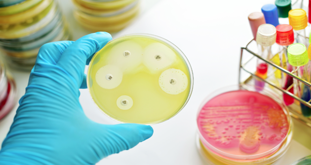 Procarta awarded £7.4M for microbial treatment | Laboratory News