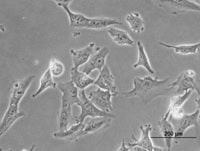 Reversing migratory cancer cells
