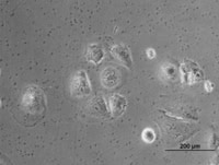 Reversing migratory cancer cells