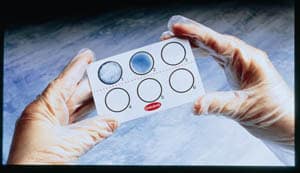 Figure 2: A positive and a negative result using the latex agglutination method.