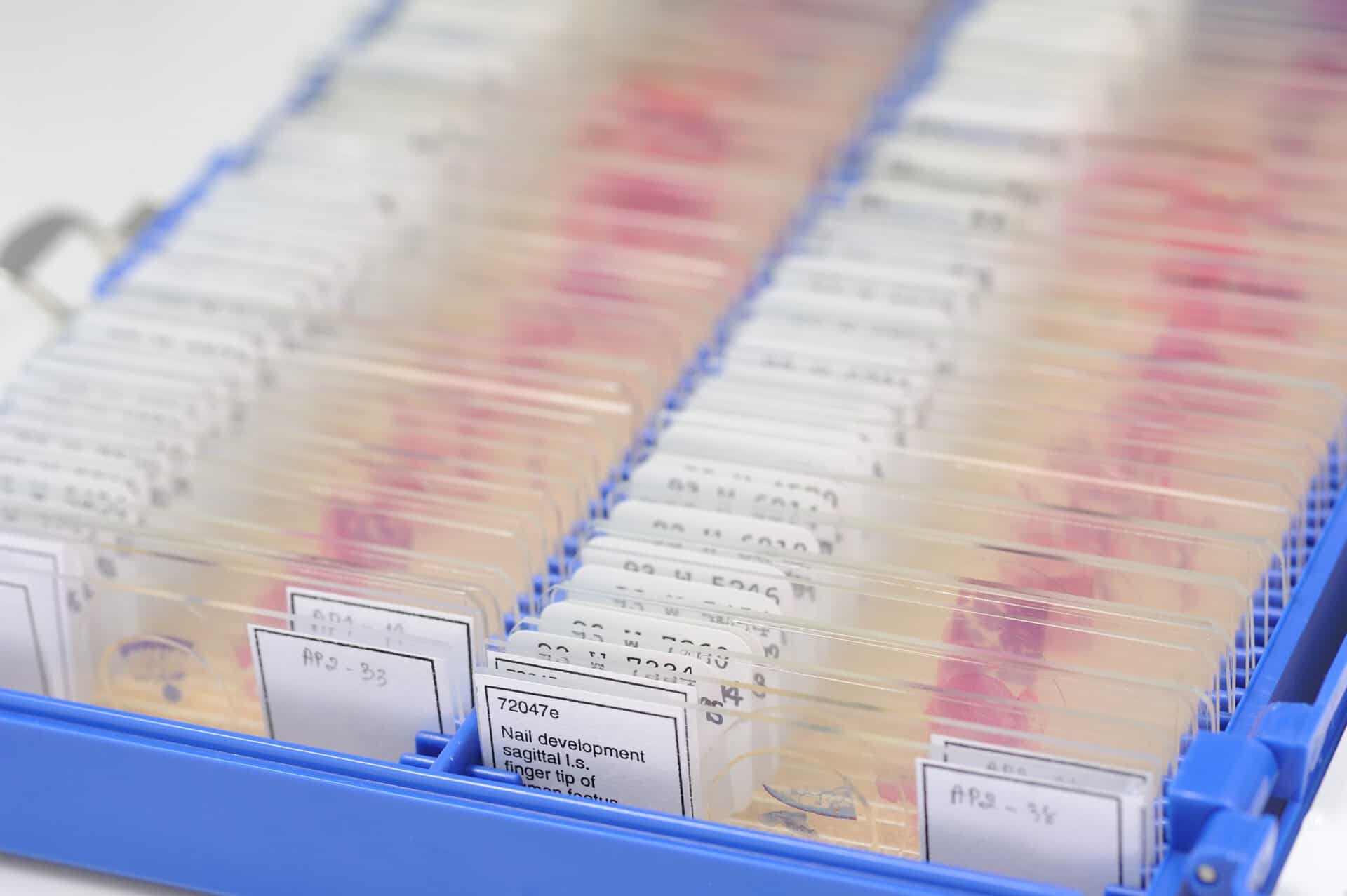 Turnaround time is an important part of measuring laboratories' efficiency.